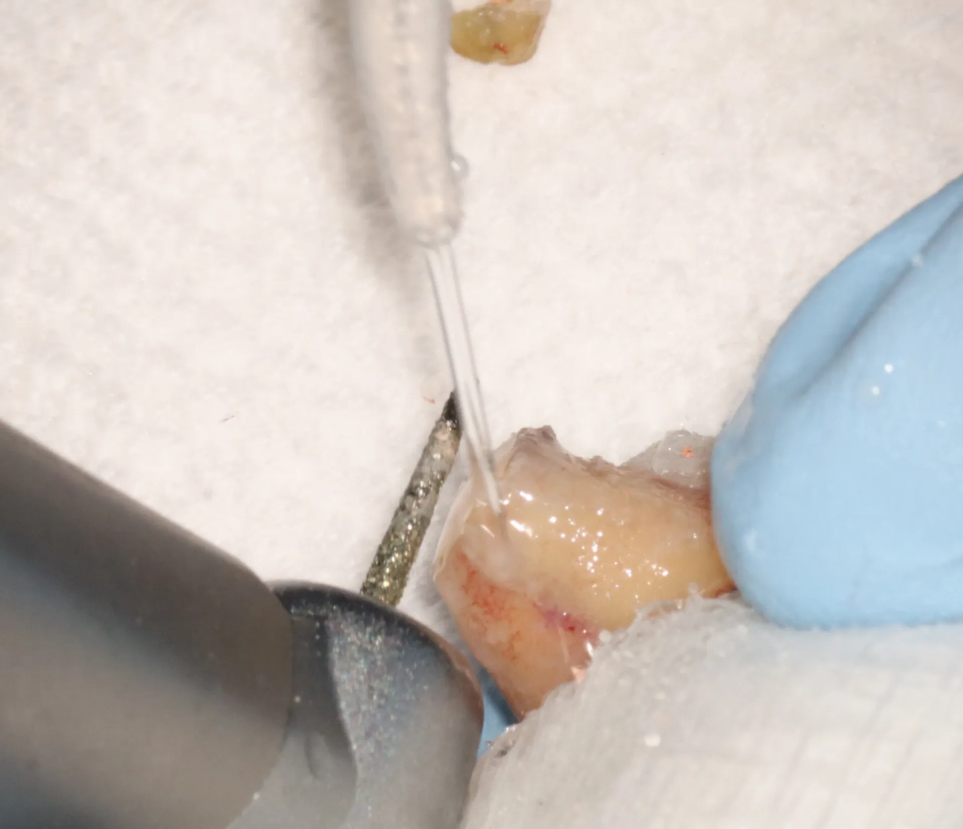 Sectioning apical fragment extraorally