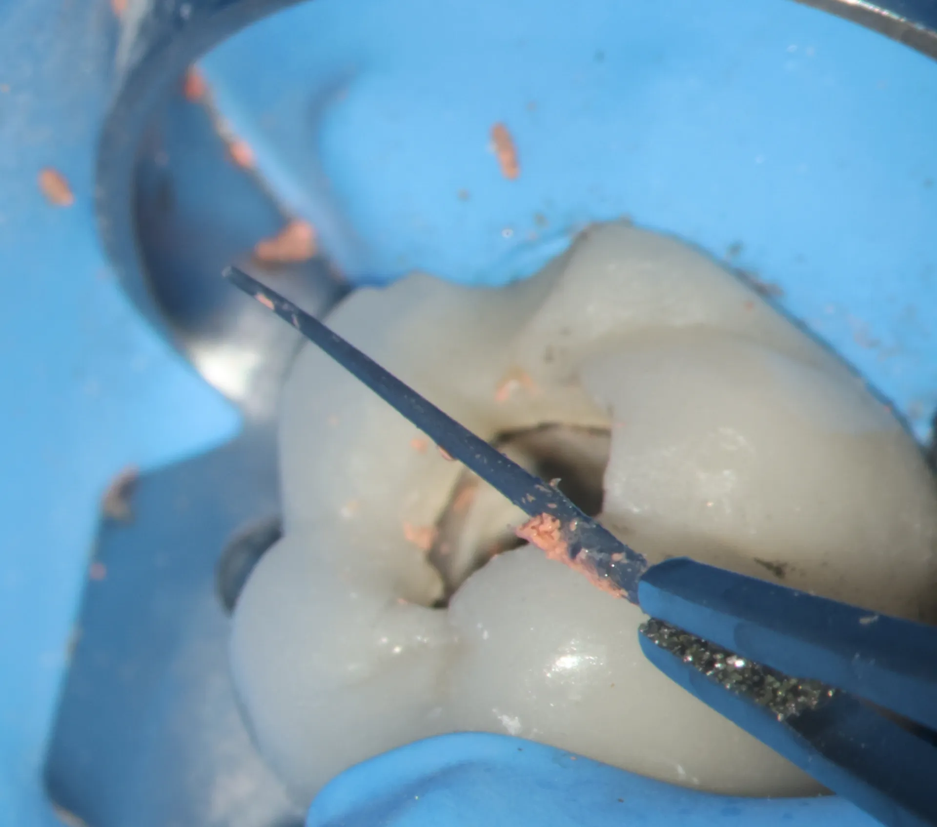 Removal of contaminated plastic carrier